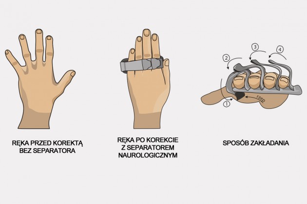 Separator neurologiczny Separator neurologiczny