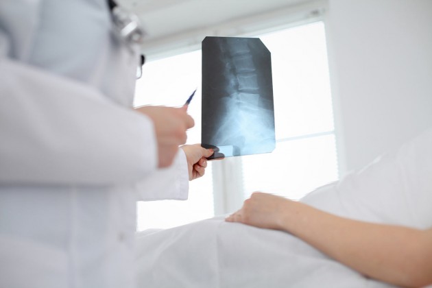 SPINEfit
