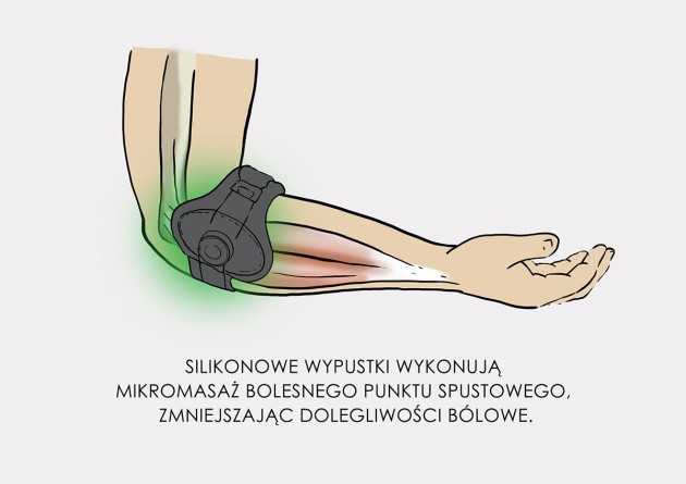 Łokieć tenisisty/Łokieć golfisty