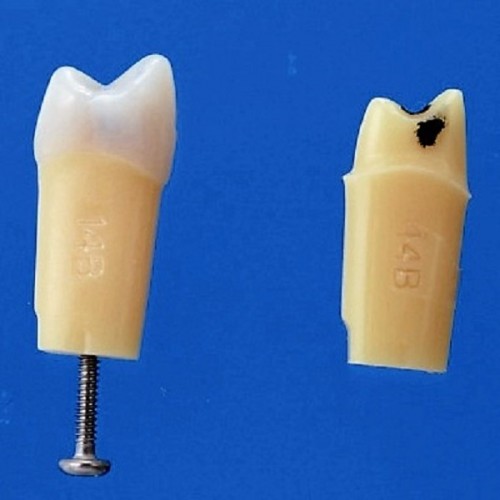 Model A27A (zęby 2-warstowe z próchnicą)